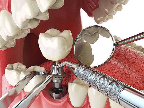 Best Tooth Pain Emergency Relief  in Worthington, OH