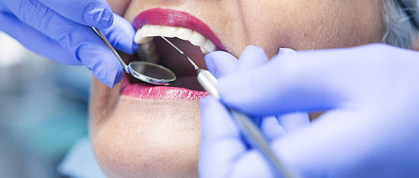 Best Broken Tooth Emergency  in Worthington, OH